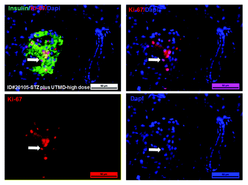 Figure 6. Transgenic expression of GLP1 in pancreatic islets, scale bar is 40 µm. (A) Baboon ID#11692, normal baboon pancreas; (B) Baboon ID#18175, STZ plus UTMD pBIP3.1-DsRed reporter gene; (C) Baboon ID#26104, STZ plus UTMD-pBIP3.1-cyclinD2/CDK4/GLP-1 genes (12 mg of plasmid); (D) Baboon ID#20105, STZ plus UTMD-pBIP3.1-cyclinD2/CDK4/GLP-1 genes (20 mg of plasmid).