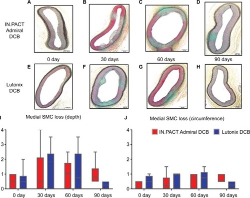 Figure 1 Representative images of histological changes after IN.PACT™ Admiral™ DCB and Lutonix® DCB treatments, and histological scores of drug biological effects in the swine femoral artery model.