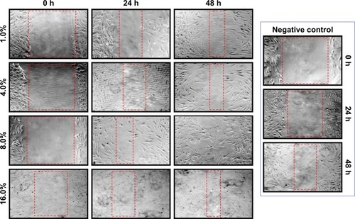 Figure 9 In vitro scratch assay.Notes: HDF cells were injured, and cell migration assay with and without treatment was performed at different times (0, 24 and 48 h) and different concentrations of BNC/Fe3O4 nanocomposites. The red boxes show distance between cells after treatment.Abbreviations: HDF, human dermal fibroblast; BNC, bacterial nanocellulose.