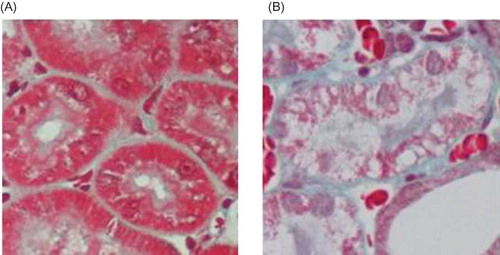 Figure 2. Masson staining (blue represents the collagen deposition). (A) No abnormal changes were detected in the Sham group. (B) The UUO group showed renal interstitium widening and collagen deposition.