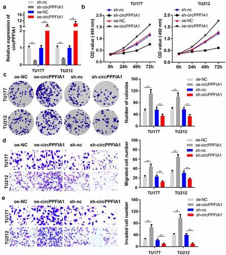 Figure 2. The effects of circPPFIA1 silencing on the proliferation and invasion of LSCC cells. (a) The transfection efficiency of si-circPPFIA1, oc-circPPFIA1 or their negative control in TH177 and TU212 cells was detected via qPCR (n = 3). (b) The proliferation of transfected TH177 and TU212 cells was tested via the MTT assay (n = 6). (c) A colony formation assay was performed to detect the growth of LSCC cells (n = 6). (d, e) Cell migration and invasion ability were analyzed via a matrigel transwell assay using transfected TH177 and TU212 cells (n = 6). **P < 0.01