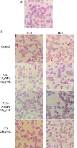 Figure 8. (A) Aspect of culture after synchronization showing healthy parasite at ring stage. Same synchronized culture was used for all tested compounds. (B) Aspect of culture after 24 and 48 h of incubation with different drugs. CQ: Chloroquine; AIL-AgNPs: A. indica leaves silver nanoparticles, AIB-AgNPs: A. indica bark silver nanoparticles.