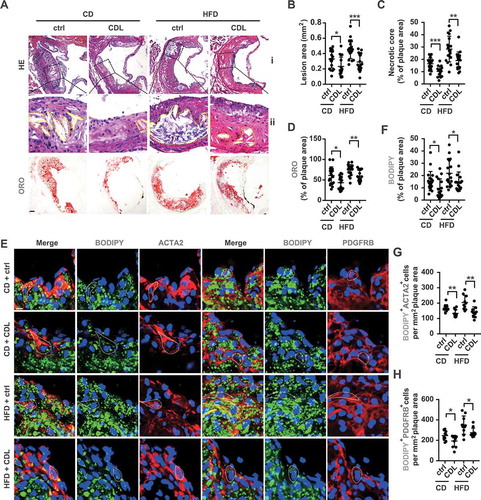 Figure 2. The P2RY12 receptor inhibitor ameliorates lipid accumulation and VSMC-derived foam cell formation in advanced atherosclerosis. (A) Representative images of aortic root sections obtained from mice in the CD + ctrl, CD + CDL, HFD + ctrl and HFD + CDL groups. For HE, (ii) Enlargement of the insert shown in (I) with the necrotic core marked by a yellow line. Scale bars: 40 μm (upper), 15 μm (bottom). For ORO, Scale bar: 40 μm. The plaque area (B) and percentage of the plaque area that was occupied by the necrotic core (C) and ORO (D) are presented (n = 19, 16, 18, and 18, respectively). (E) Fluorescence images of ACTA2-BODIPY or PDGFRB-BODIPY in aortic root sections obtained from mice in the CD + ctrl, CD + CDL, HFD + ctrl and HFD + CDL groups. Nuclei were stained with DAPI (blue). Scale bar: 20 μm. White dashed lines indicate VSMC-derived foam cells. The percentage of the plaque area that was occupied by BODIPY (F) are presented (n = 19, 16, 18, and 18, respectively) among indicated groups. The number of ACTA2+ BODIPY+ cells (G) or PDGFRB+ BODIPY+ cells (H) per mm2 of plaques in the indicated groups is presented (n = 10 per group). All data are shown as the mean ± SEM from 3 to 5 independent experiments. *, P < 0.05; **, P < 0.01; ***, P < 0.001