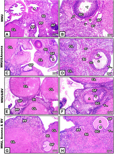 Figure 2 Microscopy of histological sections from ovaries of mother rats among the groups. (A and B) MNU; (C and (D) MNU and A. muricata; (E and F) MNU and BV; (G and H) MNU, A. muricata, and BV.