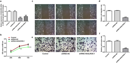 Figure 2. Effects of HAGLROS knockdown on the proliferation, migration and invasion of HFWT cells. (a) mRNA expression of HAGLROS in HFWT cells was evaluated adopting qRT-PCR. (b) Cell proliferation was assessed by CCK-8 assay after transfection with shRNA-HAGLROS-1 or shRNA-NC. (c-d) Cell migration detection of HFWT cells with different treatments employed wound healing assay. Scale bar: 100 μm. (e-f) Transwell experiment was applied for the identification of cell invasion of HFWT cells with different treatments. Scale bar: 100 μm. **P < 0.01, ***P < 0.001 vs control.