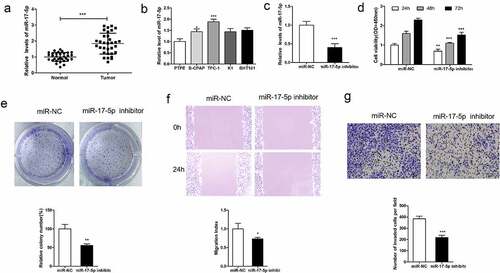 Figure 1. miR-17-5p overexpression promotes human thyroid cancer progression