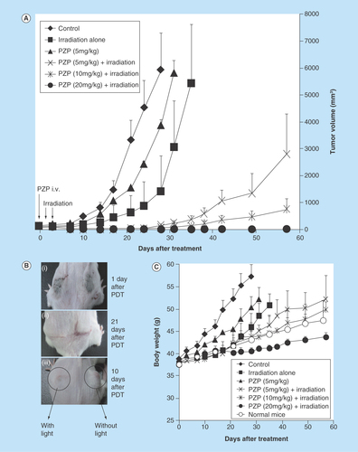 Figure 1.  Photodynamic therapy of S180 solid tumor by using polymeric zinc protoporphyrin and a xenon light source (MAX-303; Asahi Spectra): polymeric zinc protoporphyrin dose dependence.Different amounts of polymeric zinc protoporphyrin (Znpp) were injected intravenously when tumor diameters measured 5–10 mm. After 24 and 48 h, light irradiation (36 J/cm2) was performed. Tumor growth and body weight were determined every 2 or 3 days. (A) Suppression of tumor growth by PDT and PZP. (B) Macroscopic images of tumors after photodynamic therapy. With 20 mg/kg PZP (ZnPP equivalent), tumors turned pinkish to reddish and then blackish necrotic tissue appeared at 24 h after PDT (Bi); no sign of tumor growth was observed on day 21 after treatment (Bii); in one mouse bearing two tumors, the tumor receiving light irradiation clearly demonstrated shrinkage, whereas the tumor that had not had light treatment manifested no apparent effect (Biii). (C) Body weight changes after PDT. Data are means ±SD; n = 5–10. See text for details.PDT: Photodynamic therapy; PZP: N-(2-hydroxypropyl)methacrylamide copolymer-conjugated zinc protoporphyrin.