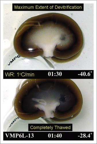 Figure 9 Visual appearance of ice in an exemplary rabbit kidney cross-section during rewarming. the kidney was perfused with M22 at −22°C, cut in half, immersed in M22, vitrified in a CryoStar freezer at −135°C, and eventually rewarmed at about 1°C/min while being photographed from time to time. Rewarming was accomplished by transfer of the kidneys to an insulated box through which liquid nitrogen vapor was circulated slowly so as to allow steady warming of the contained atmosphere from just below Tg to well above the renal melting points. Times (1:30 and 1:40) represent times in hours and minutes since the onset of slow warming, and temperatures refer to ambient atmospheric temperatures near the kidney but not within the kidney itself. The upper panel shows the kidney at the point of maximum ice cross-sectional area, and the lower panel shows the kidney after complete ice melting. Both panels show the site of an inner medullary biopsy taken for differential scanning calorimetry.