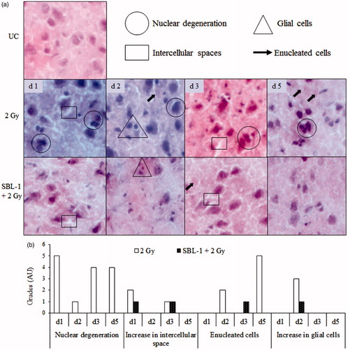 Figure 4. Effect of Hippophae leaf extract (SBL-1) on radiation-induced histological changes in cerebral cortex of rats. (a) Microscopic observations of haematoxylin- and eosin-stained tissue sections are presented at 200 × magnification. (b) Changes with respect to untreated control (UC, group I) are graded on number scale with 0 as minimum and 6 as maximum using arbitrary units (AU).