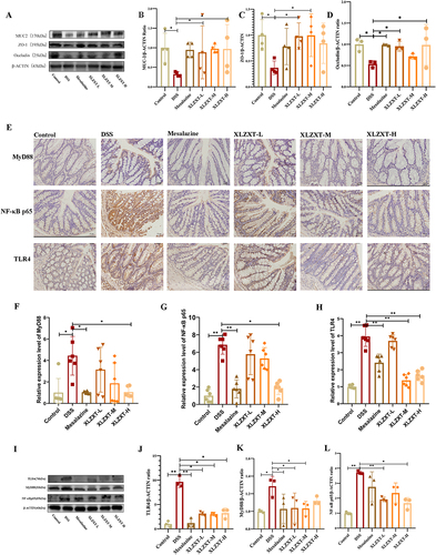 Figure 4 The effects of XLZXT on the TLR4-MyD88-NF-B signaling pathway and repairing the intestinal mucosa barrier. (A) The expression of MUC2, ZO-1 and Occludin in the colon by the WB. (B–D) Histogram statistical of the expression of MUC2, ZO-1 and Occludin in the colon by the WB. Data are expressed as mean ±SD (n=4 in each group). *P<0.05, **P<0.01. (E) The expression of -MyD88, NF-κB and TLR4 in the colon by the IHC, ×400. (F–H) The relative expression level of -MyD88, NF-κB and TLR4 in the colon by the IHC. Data are expressed as mean ±SD (n=6 in each group). *P<0.05, **P<0.01. (I) The expression of MyD88, NF-κB and TLR4 in the colon by the WB. (J–L) Histogram statistical of the expression of MyD88, NF-κB and TLR4 in the colon by the WB. Data are expressed as mean ±SD (n=3 in each group). *P<0.05, **P<0.01.