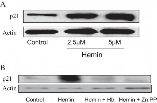 Figure 6.  A. Equal numbers of MCs were incubated in media containing either vehicle alone (control) or hemin (2.5 and 5.0 μM) for 24 hours followed by preparation of Western blots and probing for p21. The upper panel shows the effect of HO-1 induction on mesangial cell p21 expression. The lower panel shows mesangial cell actin content under the same conditions. B. Equal numbers of MCs were incubated in media containing either vehicle (control), hemin (5 μM), Hb (50 μM)+ hemin, or hemin+ zinc protoporphyrin (100 μM) for 24 hours followed by preparation of Western blots and probing for p21. The upper panel shows the effect of Hb and ZnPP on hemin-induced mesangial cell p21 expression. The lower panel shows mesangial cell actin content under the same conditions.