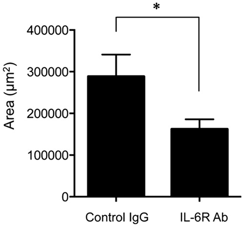 Figure 2. Neutralization of IL-6 R suppressed subretinal fibrosis. The area of subretinal fibrosis was reduced upon the intravitreal injection of neutralizing anti-IL-6 R antibody (MR16-1) compared to isotype control IgG (n = 3). The data are shown as means ± SD. The experiment was repeated three times with similar results. *p < .05.