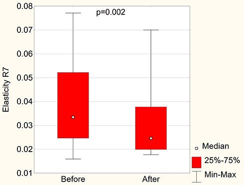 Figure 17 R7 elasticity parameter before and after carboxytherapy.
