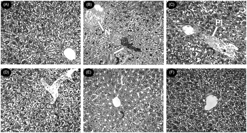Figure 6. Photomicrograph of mice liver sections (staining with hematoxylin and eosin) ×40. (A) Control mice liver shows normal cellular integrity. (B) Iron-intoxicated (iron dextran, 100 mg/kg b.w.) liver section showing necrosis (N), fatty-ballooning degeneration, inflammation (I), and loss of cellular boundaries. (C) Liver section treated with iron–dextran + 50 mg/kg b.w. NIME shows improved histology with portal inflammation (PI). (D) Liver section treated with iron–dextran + 100 mg/kg b.w. NIME. (E) Liver section treated with iron–dextran + 200 mg/kg b.w. NIME. (F) Liver section treated with iron–dextran + 20 mg/kg b.w. desirox shows reduced necrotic area and the increased number of hepatocytes. S100 and S200 show reduced hepatocellular necrosis, ballooning degeneration, and inflammation indicating a trend of restoration of normal cellular integrity.