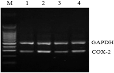 Figure 5. COX-2 mRNA expression in rat liver tissue assessed by RT-PCR. M, molecular size marker; Lane 1, normal control group; Lane 2, model group; Lane 3, COX-2 shRNA-1 group; Lane 4, empty vector group.