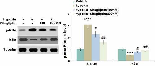 Figure 7. Sitagliptin attenuated hypoxia-induced phosphorylation and degradation of IκBα. Cells were stimulated with Sitagliptin (100, 200 nM) for 2 hours, followed by exposure to hypoxia for 6 hours. p-IκBα and total IκBα (****, P < 0.0001 vs. vehicle group; #, ##, P < 0.05, 0.01 vs. Sitagliptin group, n = 5).