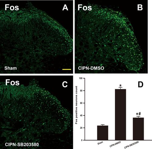 Figure 8 Reduction of c-Fos expression in spinal cord by intra-RVM microinjection of SB203580. The immunofluorescence of c-Fos in the spinal dorsal horn. (A) Sham group; (B) CIPN-DMSO group; (C) CIPN-SB203580 group; (D) Fos positive neurons count (* vs Sham group, P < 0.05, # vs CIPN-DMSO group, P < 0.05, n = 4 per group). Bar: 100 μm.