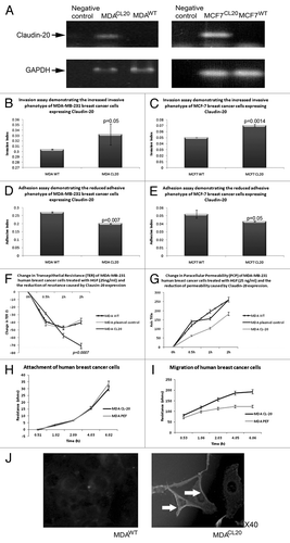 Figure 2. Effect of CLaudin-20 overexpression in human breast cancer cells. Confirmation of CLaudin-20 expression in MDA-MB-231(left) and MCF7 (right) cells (A). Increased invasive behavior of MDA-MB-231 (B) and MCF7 (C) cells overexpressing Claudin-20. Reduced adhesion to basement membrane of MDA-MB-231 (D) and MCF7 (E) cells overexpressing Claudin-20. Clausin-20 overexpression reduces transepithelial resistance (F) and paracellular (G) of MDA-MB-231 cells. Claudin-20 did not change attachment of MDA-MB-231 cells (H). MDA-MB-231 cells overexpressing Claudin-20 exhibited increased migratory phenotype (I). Imunofluorescent staining to show confirmation of Claudin-20 overexpression in MDA-MB-231 cells (J).