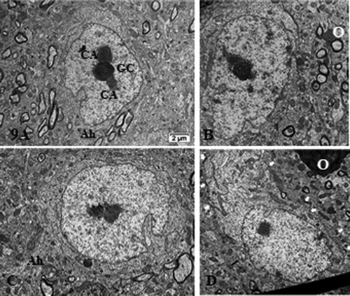 Figure 9. (a–d): Pane with ODS12h nerve cell bodies preserved, adjacent to the demyelinated zone of the ventrolateral thalamus showing typical euchromatic nuclei with prominent nucleoli where components, although evident in all the featured micrographs, do not form NORs and are centrally placed and somewhat segregated into CA and GC regions. In (b and d), highly contrasted oligodendrocyte section parts in the surrounded neuropil (O). In (d), small white arrows display examples of axo-somatic synaptic sectors. Ah: axon hillock; G: Golgi zone; arrow shows autophagosome. Scale in A is the same for (b–d)