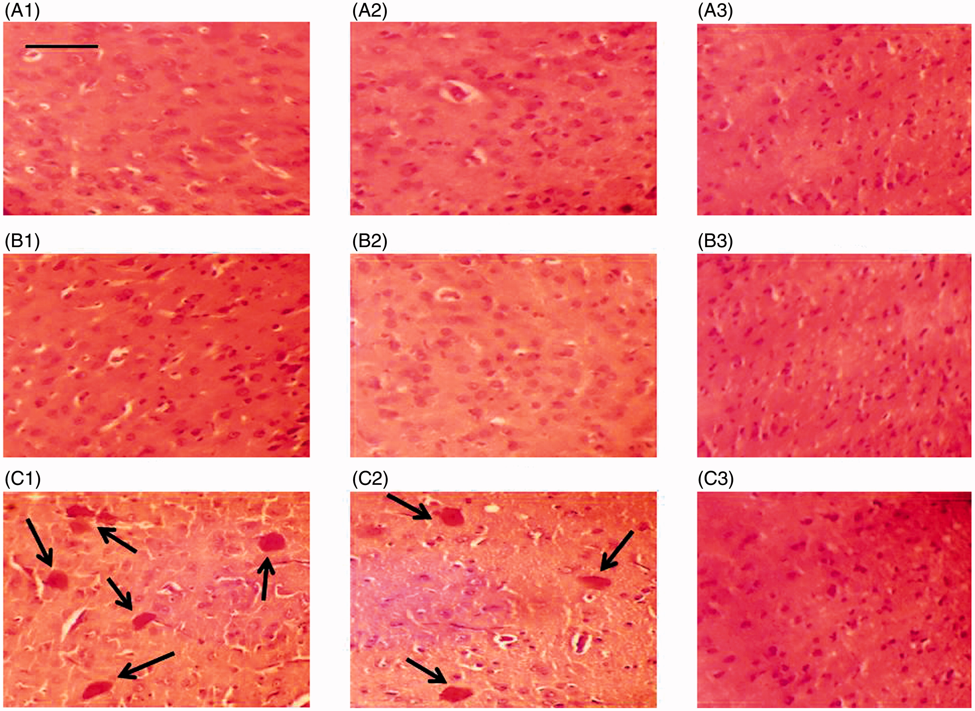 Figure 4. Staining (Congo red) of plaques in different brain areas in rats. Representative micrographs are shown. Control rats: (A) (top row); sham-operated rats: (B) (middle row); icv colchicine injected rats: (C) (last row). Frontal cortex: 1 (left column), parietal cortex: 2 (middle column), occipital cortex: 3 (right column). Letter and number indicate group and specific brain region (e.g, A1: Frontal cortex, control rat). Magnification: 400×, length of bar = 16.18 μm. Arrows indicate plaques.