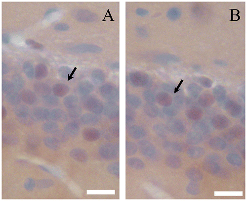 Fig. 3. BrdU-immunostaining.Notes: Photomicrograph of BrdU-positive cells (arrowhead) in the dentate gyrus of aged mice (A, Control; B, 200 mg/kg CMT). Scale bar = 10 μm.