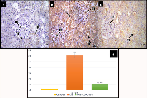 Figure 9. Immune histochemical-stained sections for mTOR showing cytoplasmic and nuclear immune reaction (m). a Control group, few mTOR immunoreactive cells can be detected. b DN group, showing increased mTOR immune reactions both in the tubular and the glomerular cells. c DN + ZnO-NPs group, some immune reactive cells are seen. d The mean area % of positive immunoreactions in anti-mTOR immune-stained sections. Estimates are displayed as mean ± standard errors (X ± SEM); a: P compared to control group; b: P compared to DN group; #: P< .05; ##: P< .001.