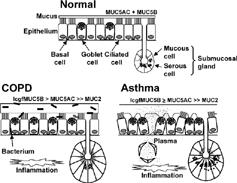Figure 3 Putative differences in airway mucus pathophysiology between COPD and asthma. Compared with normal, in COPD there is increased luminal mucus, goblet cell hyperplasia, submucosal gland hypertrophy (with an increased proportion of mucous to serous acini), an increased ratio of mucin (MUC) 5B (low-charge glycoform, lcgf) to MUC5AC, small amounts of MUC2, and respiratory infection (possibly due to reduced bacterial enzymatic shield from reduced serous cell number). Pulmonary inflammation includes macrophages and neutrophils. In asthma, there is increased luminal mucus, epithelial fragility, marked goblet cell hyperplasia, submucosal gland hypertrophy (although without an increased mucous to serous ratio), tethering of mucus to goblet cells, and plasma exudation. Airway inflammation includes T lymphocytes and eosinophils. Many of these differences require more data from greater numbers of subjects.