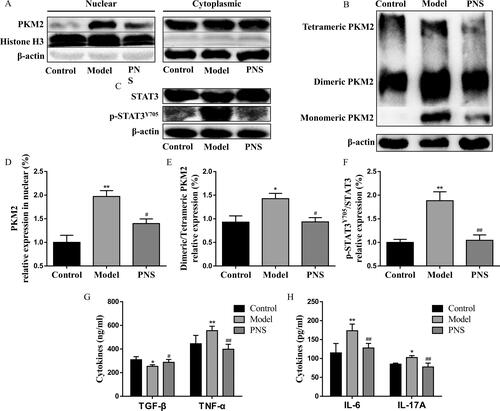 Figure 9. PNS repressed the PKM2/STAT3 signaling pathway to attenuate inflammation in the CIA model. DBA/1J mice were immunized with bovine type II collagen emulsified in complete Freund adjuvant and incomplete Freund adjuvant. Mice were treated at day 21 after the first immunization with saline or PNS (100 mg/kg). (A) Nuclear and cytoplasmic fractions were isolated by cell fractionation from splenic CD4+T cells of CIA mice and analyzed for PKM2 expression by western blots. Histone H3 and β-actin were used as nuclear and cytoplasm loading controls, respectively. (B) Splenic CD4+T cells from CIA mice were crosslinked with DSS and analyzed for dimeric/tetrameric PKM2 expression by western blots. β-Actin was used as a loading control. (C) Splenic CD4+T cell lysates from CIA mice were subjected to a western blot of total and phospho-STAT3 (Y705) expression. β-Actin was used as a loading control. Data were expressed as the mean ± SEM (n = 6). *p < 0.05, **p < 0.01, compared with the control group, #p < 0.05, ##p < 0.01, compared with the model group, by one-way ANOVA with Tukey’s post hoc test.
