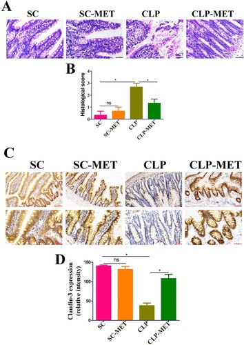 Figure 2. The effect of metformin on inflammation and intestinal barrier of the colon in aged rats. (A,B) H&E staining indicated that inflammatory infiltration, oedema, and haemorrhage of colon tissues significantly increased in the CLP group compared with SC and SC-MET groups, whereas these abnormalities improved in the CLP-MET group (bar = 100 μm). (C,D) The IHS expression results of claudin-3 protein expression (bar = 50/100 μm). *P < 0.05, **P < 0.01, ***P < 0.001 (n = 3/group).