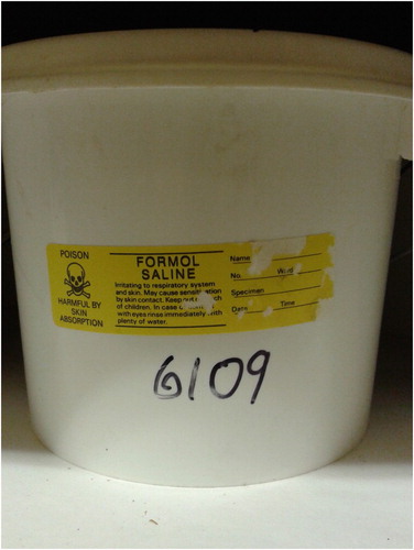 Figure 2. Placentas are stored in individual buckets or in individually sealed batches of up to ten placentas in larger storage containers. Reproduced by kind permission of the ALSPAC Executive.