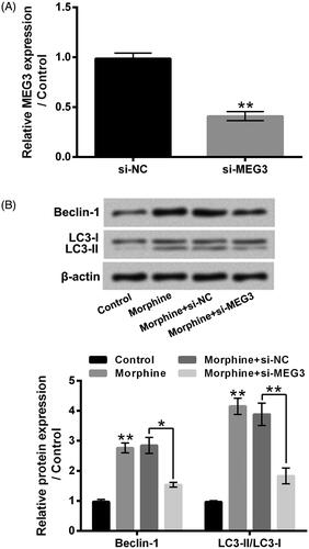 Figure 4. MEG3 took part in the influence of morphine on HT22 cell autophagy. (A) Followed by si-NC or si-MEG3 transfection, the MEG3 expression in HT22 cells was tested by qRT-PCR. (B) Followed by 10 µM morphine treatment and/or si-MEG3 transfection, the Beclin-1 and LC3 protein levels in HT22 cells were tested by western blotting. MEG3: LncRNA maternally expressed gene 3. *p ˂ 0.05, **p ˂ 0.01.