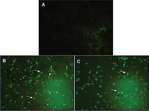 Figure 4 Microscopic evaluation of the PS externalization.