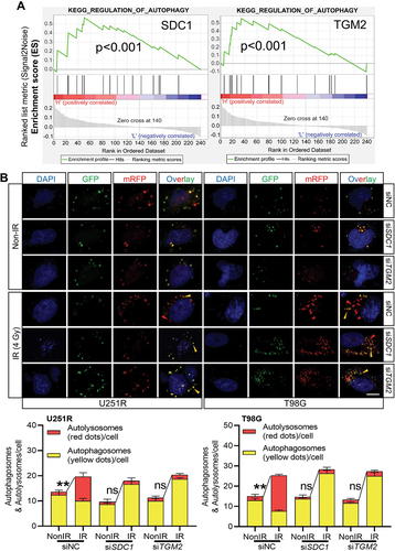 Figure 3. Inhibition of SDC1 and TGM2 suppressed autolysosome formation. (A) KEGG pathway enrichment analysis of SDC1 (left) and TGM2 (right). (B) Representative image of the mRFP‐GFP‐LC3 fusion protein expressions in U251R and T98 G cells under different siRNAs transfection at 6 h after 4 Gy IR. Red dots indicate autolysosomes while yellow dots indicate autophagosomes in overlays. Nuclei were stained with DAPI. Scale bars: 10 μm. The average number of autophagosomes and autolysosomes in each indicated cell was quantified. ns P ≥ 0.05 and **P < 0.01.