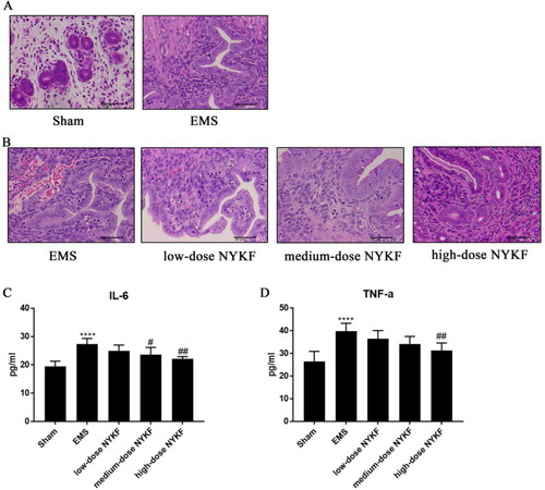 Figure 2. NYKF controls the progression of endometriosis in EMS mice. A: HE staining proved the establishment of EMS model. B: Endometrial lesions and pathologic changes in the EMS mice (n = 6), low-dose NYKF group (n = 6), medium-dose NYKF group (n = 6), and high-dose NYKF group (n = 6) were observed by HE staining (×400). Scale bar: 50 μm. ELISA was performed to measure the protein levels of IL-6 (C) and TNF-α (D). Data are shown as means ± SD (n = 6), and data between multiple groups were compared by one-way ANOVA. **p < .01 compared with Sham group; #p < .05, ##p < .01 compared with EMS group.