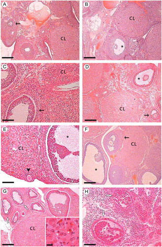 Figure 6. Effect of ex vivo noradrenergic stimulation of SMG and denervated ovary on ovarian histology. Estrus stage: (A) Ovary control of the ex vivo system. Ovarian cortex, secondary follicles (arrow), and CL with normal histological structure are observed; (B) Ovary without peripheral neural influence. CL and antral follicle (*) with normal histological structure are observed; (C) Ovary under the influence of noradrenergic stimulation of SMG via OPN; (D) Ovary stimulated with 10−6 M NA. In both C and D, secondary follicles (arrow), antral follicle (*) and CL with preserved histology are observed. Diestrus II stage: (E) Ovary control of the ex vivo system. CL, primary follicle (arrowhead), and antral follicle (*) with normal histological structure are observed; (F) Ovary without peripheral neural influence. CL, secondary follicles (arrow), and antral follicle (*) with normal histological features are observed; (G) Ovary under the influence of noradrenergic stimulation of SMG via OPN. Some ovarian follicles present histoarchitecture alterations (white arrows). Inset: Disorganized luteal cells with signs of nuclear and cytoplasmic alterations (*); (H) Ovary stimulated with 10−6 M NA. Follicles with histological alterations are observed, compatible with a possible atretogenic effect (white arrows). n = 4 animals per experimental group. CL: corpus luteum; NA: Noradrenaline; OPN: ovarian plexus nerve; SMG: superior mesenteric ganglion. Hematoxylin-eosin. Scale bar: A, B, D, F, G and H: 250 µm; C and E: 100 µm; Inset: 12.5 µm.