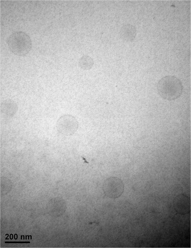 Figure 4 TEM image of NLC optimized by Box-Behnken design. The scale bars represent 200 nm.