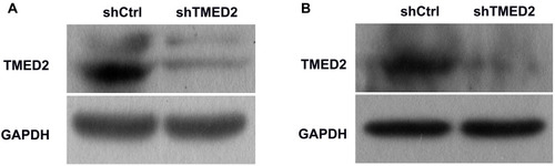 Figure 4 Western blot analyses of the levels of the TMED2 protein in MM.1S (A) and RPMI 8226 (B) cells. GAPDH served as a loading control.