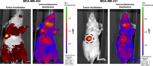 Figure 4 Spectral unmixing of dTomato+ MDA-MB-453 and MDA-MB-231 bearing mice, 5 days after administration of DiR-labeled immunoliposomes.Abbreviation: MDA-MB, derived from metastatic site: mammary breast.