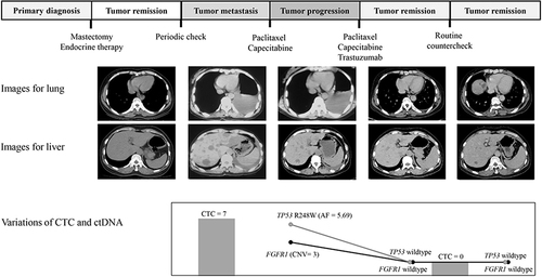 Figure 4 Variations of imaging and molecular biomarker features in Patient ID3 during a series of medical treatments. Treatment process is showed in the top. Images of the lung (upper) and liver (lower) metastasis are listed in the middle. Variations of CTC (grey column) and ctDNA (black line for CNV of FGFR1; grey line for mutation of TP53 R248W) are presented in the bottom.