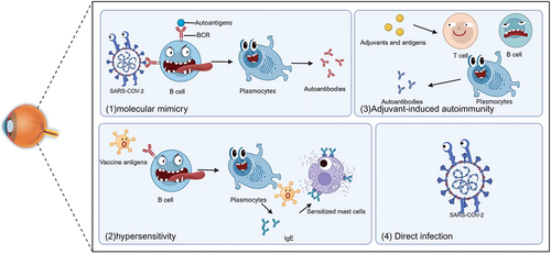 Figure 2. The potential mechanisms of COVID-19 vaccine-associated MEWDS. Including (1) molecular mimicry,Citation36 (2) hypersensitivity reactions,Citation37 (3) adjuvant-induced autoimmunity,Citation38 and (4) direct infection with attenuated, live vaccines.Citation13