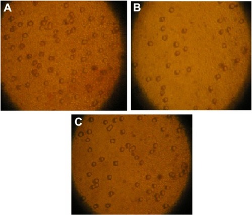 Figure 1 (A–C) Effects of Fe3O4-dextran-anti-β-human chorionic gonadotropin (HCG) carrying heparanase (Hpa) antisense oligodeoxynucleotide (ASODN) on JEG-3 cell invasion. (A) Untransfected cells. Cells on the lower surface of the insert chamber were counted under microscope with 80× magnification. (B) Fe3O4-dextran-anti-βHCG-Hpa ASODN-treated cells. (C) Fe3O4-dextran-anti-βHCG-Hpa NSODN-treated cells.Abbreviation: NSODN, non-sense oligonucleotides.