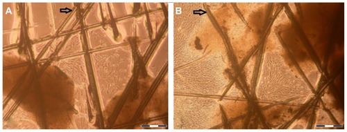 Figure 1 Isolated hTGSCs. hTGSCs at (A) day 3 and (B) day 8.Notes: Scale bar = 400 μm. Cells started to grow from human tooth germ tissues that were dismembered and minced by scalpel (resulting scratches on the flask surface are marked by arrows).Abbreviations: hTGSCs, human tooth germ stem cells.