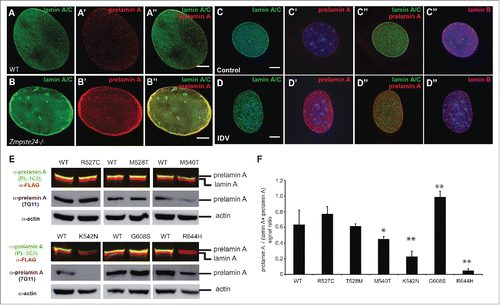 Figure 5. Lack of ZMPSTE24 expression or activity increases prelamin A levels, but laminopathy -associated missense lamin A mutations exert different effects on prelamin A accumulation. (A) and (B). Zmpste24−/− and wild type MEFs were co-stained with anti-lamin A/C (green) and anti-prelamin A (Red) antibodies. Increased prelamin A levels can be observed in the absence of the sequence specific protease. (C) and (D). C2C12 cells were treated with the HIV protease inhibitor indinavir (IDV), which inhibits ZMPSTE24 activity. Cells were co-stained as described in A and including an anti-lamin B antibody as control. (E). Analysis of prelamin A accumulation in laminopathy-associated missense lamin A mutations. Dual infrared immunoblots of total proteins from cells transfected with 3XFLAG-tagged human LMNA constructs containing different laminopathy-associated mutations including: R527C, T528M, M540T, K542N, G608S and R644H. Blot shows the anti-prelamin A PL-1C7 antibody in green (800 nm channel) and a rabbit anti-FLAG antibody in red (700 nm channel). Membranes were re-blotted with anti-prelamin A 7G11 and β-actin antibodies (loading control) and evaluated by chemiluminescence. (F). Quantification of prelamin A levels in laminopathy-associated mutations. Ratio of prelamin A (800 nm channel)/ Total lamin A/prelamin A (700 nm channel) is shown. Values represent the mean +/− SD, * p< 0.005, ** p< 0.001. See also Fig. S4.