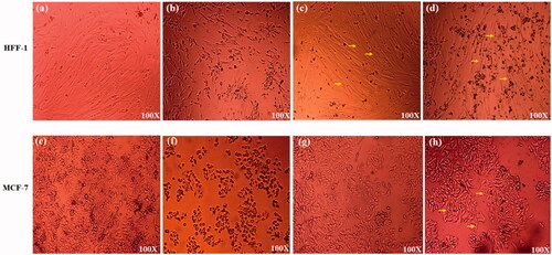 Figure 4. Cell morphology of treated HFF-1 and MCF-7 cells. (a, e) Fe/S-16 (Control), (b) Cisplatin treatment (G-II) (0.018 mg/ml), (c) Fe/S-16-AP-Cp treatment (G-III) (0.24 mg/ml), (d) Fe /S-16-A-Cp treatment (G-IV) (0.24 mg/ml). (f) Cisplatin treatment (G-II) (0.041 mg/ml), (g) Fe/S-16-AP-Cp treatment (G-III) (0.22 mg/ml), (h) Fe/S-16-A-Cp treatment (G-IV) (0.22 mg/ml). Yellow arrow shows the SPIONs inside the cells.