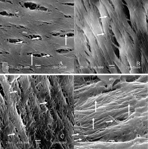 Figure 4.  Observation of collagen fibers within the bone trabeculae by SEM (×10,000). A: Collagen fibers of a bone trabecula in a man of 26 years. The fibers were closely arranged, and the orientation was consistent (A: the long arrow). The fibrils were connected obliquely by the thinner collagen fibers (A: the short arrow) for reinforcement. B: Collagen fibers of 35 years. C: Collagen fibers of 48 years. With increasing age, the widths of the collagen fibrils were not consistent (C: the short arrow). However, the orientations of the collagen fibrils were essentially uniform, D: Collagen fibers of 55 years. The arrangement of the fibrils was loose, sparse and disordered (D: the long arrow). The orientations of the oblique collagen fibers between them were unorganized (D: the short arrow).