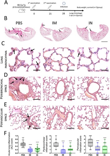 Figure 8. SARS-CoV-2-mediated histopathological changes in the lungs of non-vaccinated, as well as IM or IN vaccinated K18-hACE2 mice. (A) Study design. (B). Haematoxylin and eosin (H&E) stained sections of mouse lungs, arrows pointing to inflammation foci; bar = 2 mm (C). Representative H&E sections of the lung parenchyma, arrows show neutrophils in the interalveolar septa; bar = 30 µm. Representative H&E sections aimed on (D) peribronchiolar and (E) perivascular spaces. Arrows indicate inflammatory infiltration. Bar = 100 µm. (F) Acute lung inflammation (ALI), peribronchiolar and perivascular scores from 10 random fields / 10 random bronchioles / 10 random vessels, respectively, for each of three mice in one experimental group (n = 30). Boxes show the interquartile range, whiskers show the range, and horizontal lines represent the median values. Dots show individual data points. Significant differences between vaccinated and non-vaccinated animals were calculated using by two-way ANOVA (**** P < 0.0001).