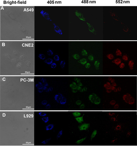 Figure 4 Bright-field (left) and fluorescence images (right; λmax excitation = 405nm, 488nm, and 552 nm) taken using confocal microscopy of (A) A549, (B) CNE2, (C) PC-3M, and (D) L929 cells incubated with CQDs (1 µM) for 12 h.