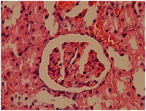 Figure 4. Microscopic structure of kidney of a glibencalmide-treated diabetic rat showing only a mild glomerular distension. The slide stained with hematoxylin and eosin (original magnification ×10).