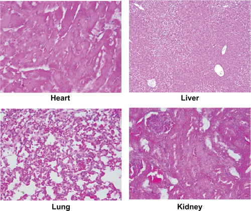 Figure S3 Histological analysis of heart, liver, lung, and kidney tissues following an injection of Fe3O4@C and NIR irradiation.Note: Images were captured at 400× magnification.Abbreviation: NIR, near-infrared.