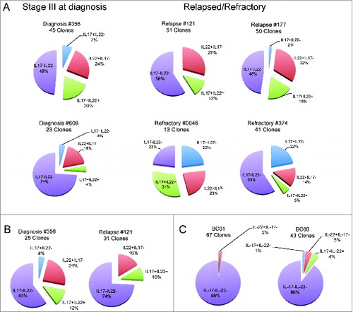 Figure 2. Distribution of CD4+CCR6+ T-cell clones based on the profile of IL-22 and IL-17 secretion. Cake graphs of percentages of IL-22+IL-17− (red slices), IL-22+IL-17+ (light blue slices), IL-22−IL-17+ (green slices), and IL-22−IL-17− (violet slices) clones obtained from the (A) BM of MM patients (B) and PB of MM patients, and (C) healthy donors. Clonal efficiencies for cloning conducted after in vitro expansion were (A) 48.2% and 55.6% for BM of patients #356 and #121, respectively and (B) 25.4% and 21.1% for PB of the same patients, respectively. (C) Clonal efficiencies for PB of healthy donors were 45.8% and 76.9% for BC01 and BC60, respectively. Clonal efficiencies for cloning conducted immediately after sorting were 4%, 11.9%, 2.3%, and 7.6% for BM of patients #609, #177, #0046, and #374, respectively (A). For patient characteristics, see Table 1.